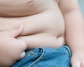 Homeopathy Treatment of Obesity