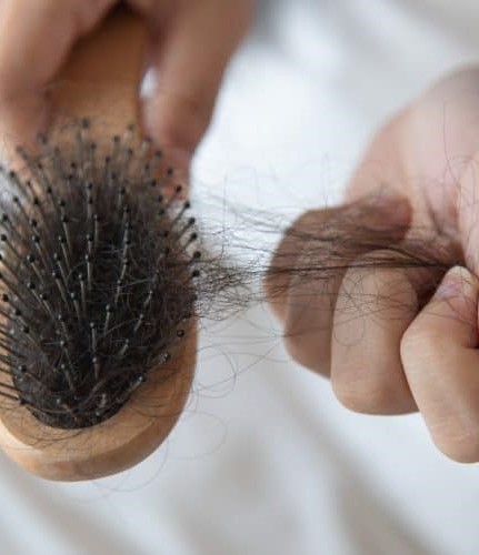 OHO Homeopathy Hair Treatment